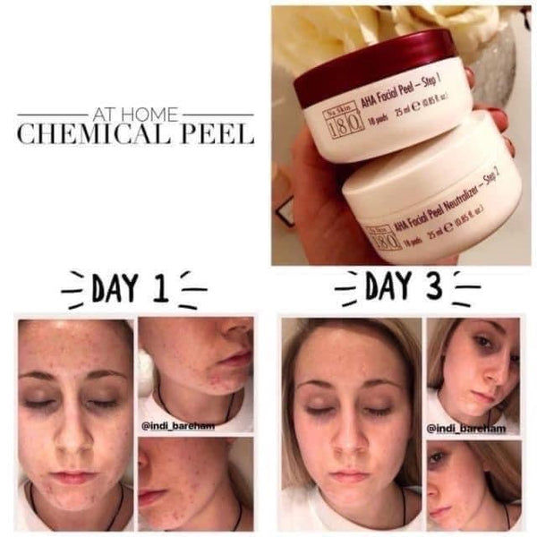 180°® AHA Facial Peel and Neutralizer